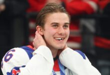 Did Jack Hughes Lose a Tooth in the Olympics? How He Lost Front Teeth – Hollywood Life